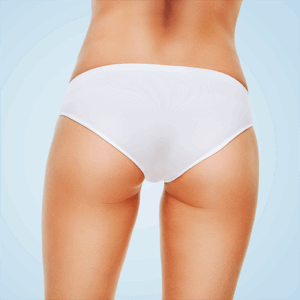 Epilation laser fesses