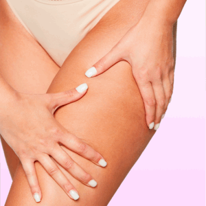 Epilation laser pour réduire les poils incarnés