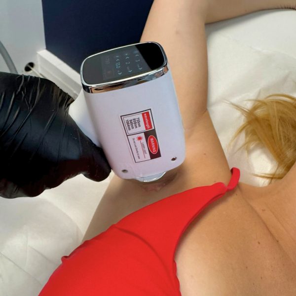 Epilation laser aisselles