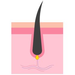 Phase catagène - Epilation laser peu efficace